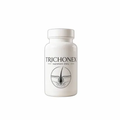 Trichonex — Zdjęcie 5